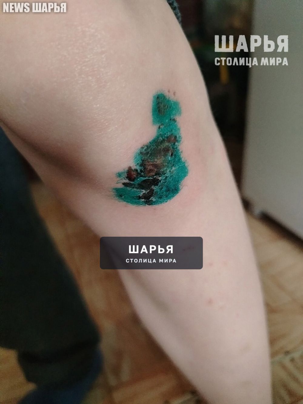 Шарьинцы продолжают получать травмы, пока администрация "закупает материалы" — Шарья