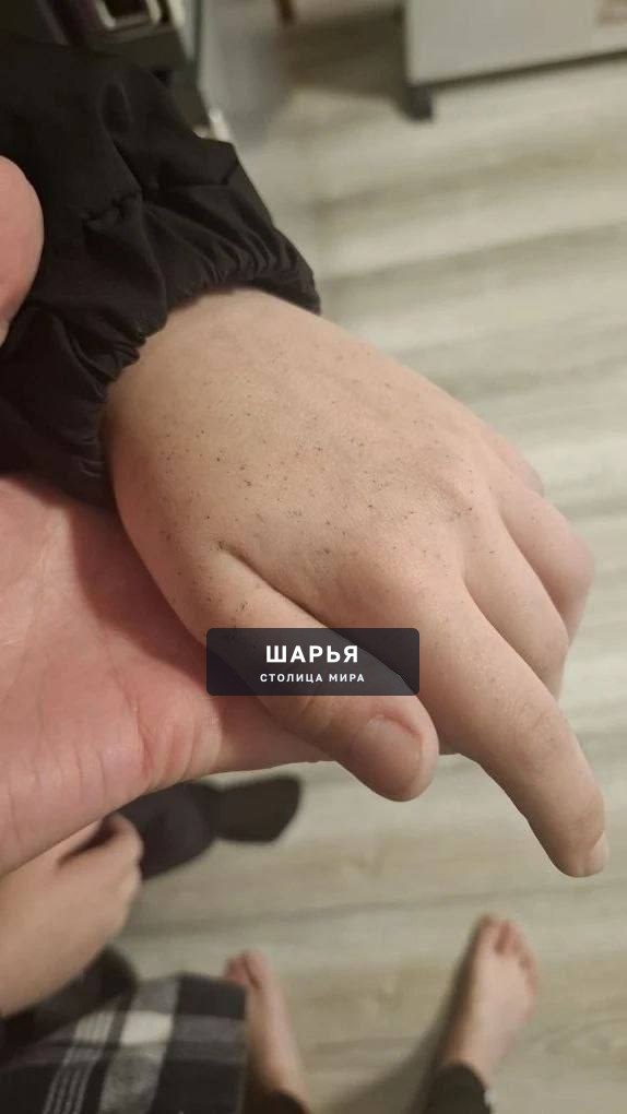 Беда в Туапсе. В городе экологическая катастрофа после пожара на морском терминале из-за атаки… — Шарья — фото 5