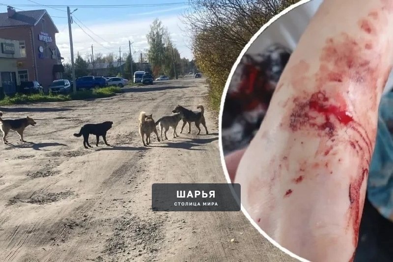 В Шарье проверяют нападения бездомных собак на детей — Шарья