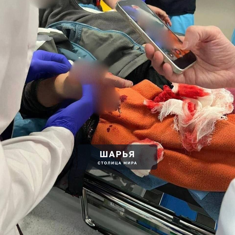 Будьте аккуратны, сообщите всем, кому можете и не подбирайте деньги - мальчику оторвало пальцы — Шарья — фото 2